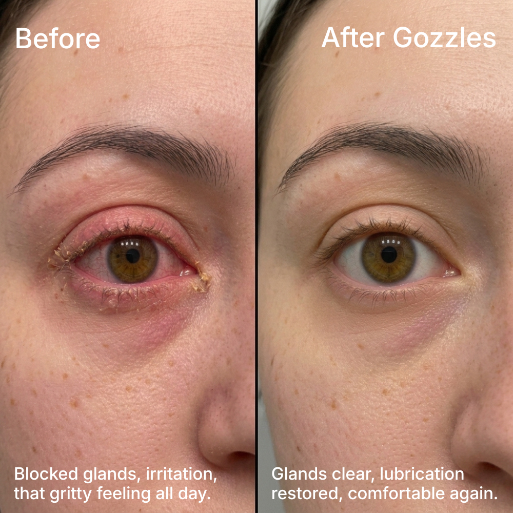 Gozzles™ Heated Eye Mask