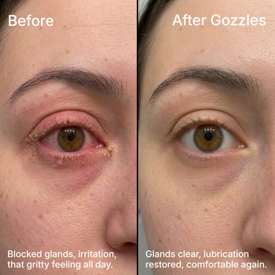 Gozzles™ Heated Eye Mask